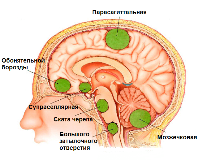 Реабилитация после операции на головном мозге