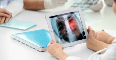 Когда следует сделать скрининг на рак лёгких — лечение в ведущей клинике Турции